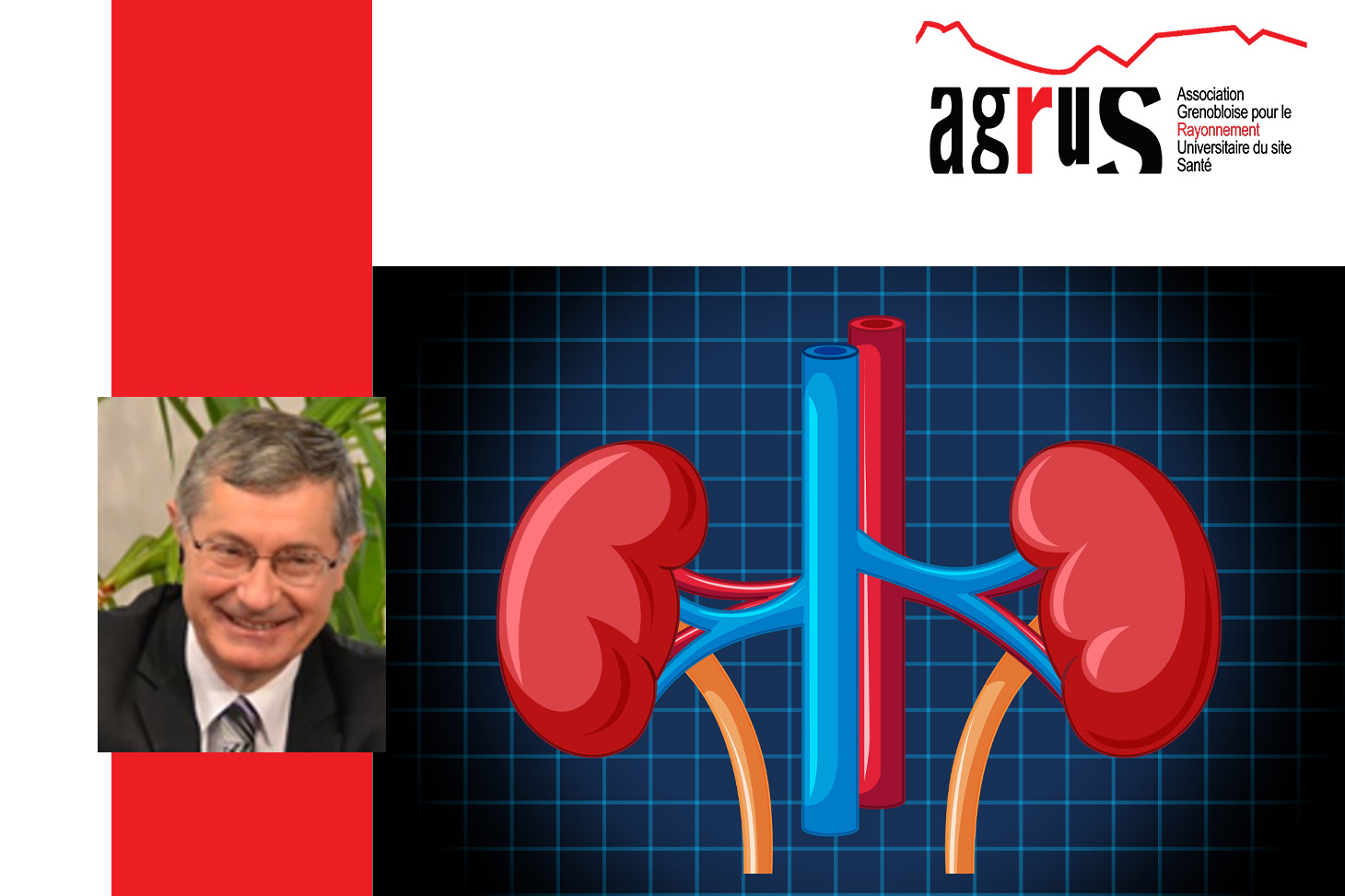 Conférence AGRUS - Greffes rénales